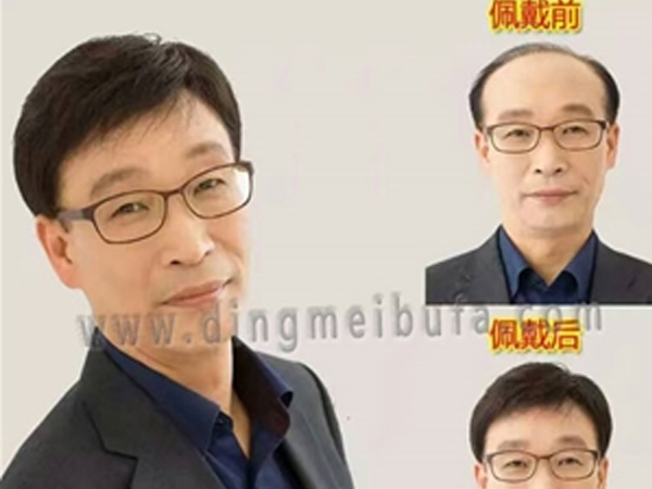 南陽男士假發(fā)價格 南陽男士假發(fā)價格