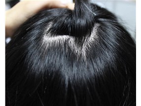 補發(fā)后，一般具有哪些特征呢？